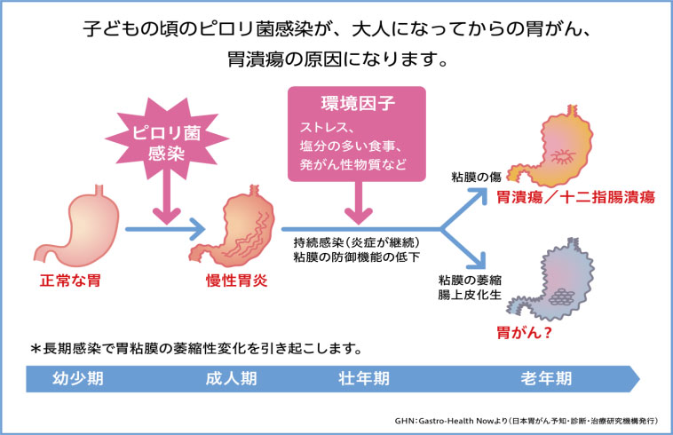 消化器の主な病気について