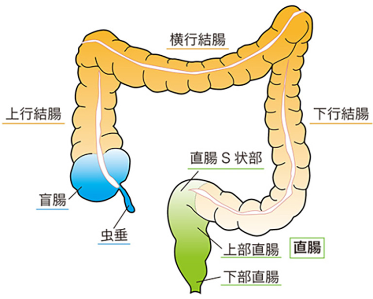 大腸がん